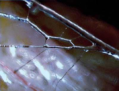 fascia-2