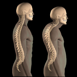 posture